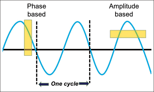 The respiratory sine wave