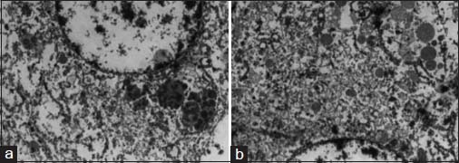 Electron microscopy images show membrane-bound electron-dense granules (a) secretory vesicles and mitochondria (b)