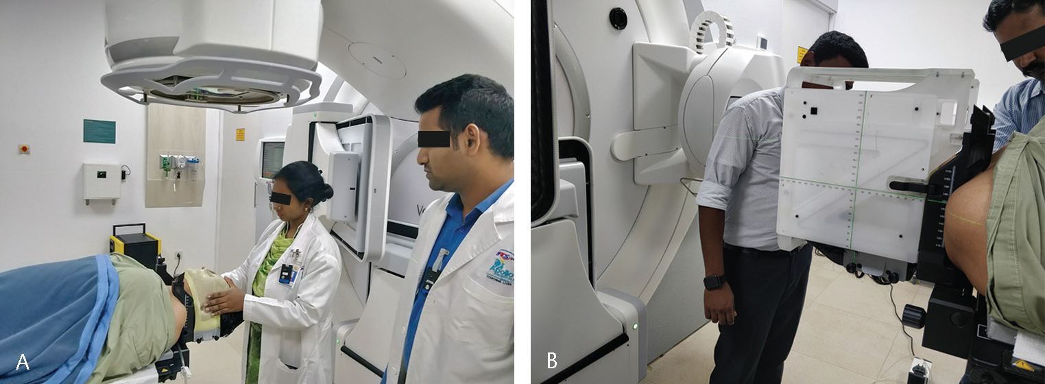 Fig. 1 (A) Preparation of the stereotactic radiotherapy (SRS) mask on the headrest attached to the treatment couch. (B) SRS mask with the stereotactic localizer box.