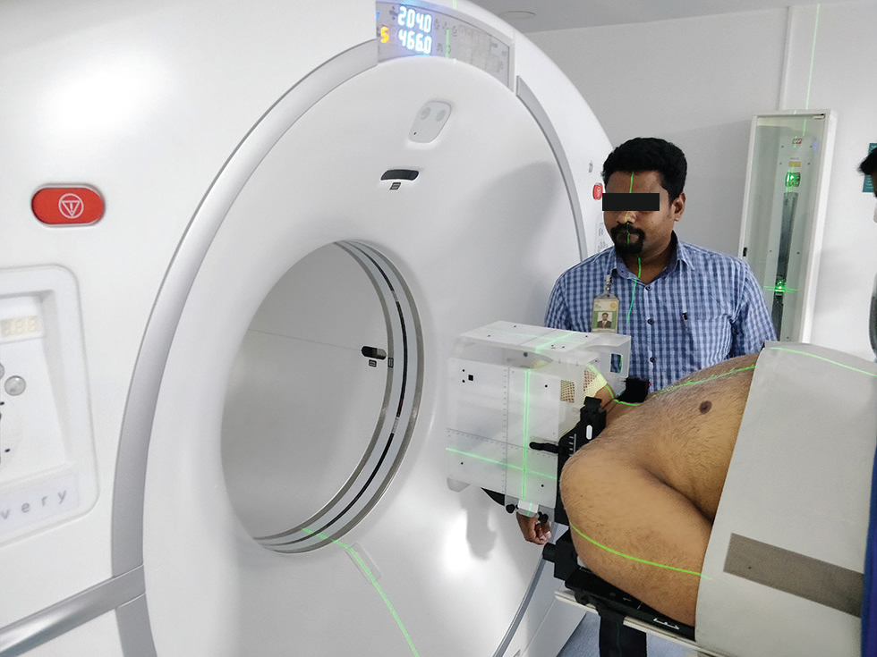 Fig. 2 Acquiring CT (computed tomography) simulation image with the stereotactic localizer box.