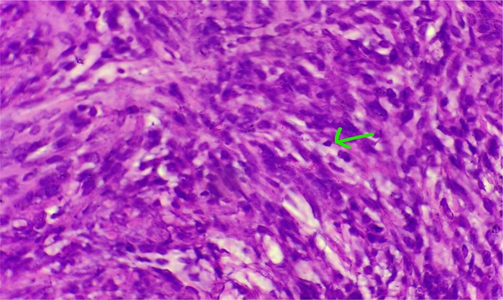 Fig. 5 Mitotic figure.