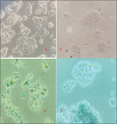 1 Hep G2 cells (24 h), 2 Bryonia 6C treated HepG2 oells (24 h), 3 Methylene blue stained Bryonia 6C treated HepG2 cells (24 h), 4 Methylene blue stained control alcohol treated HepG2 cells (24 h).