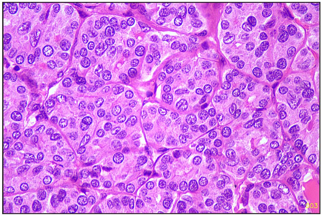 Follicular area (Hematoxylin and eosin, 40x).